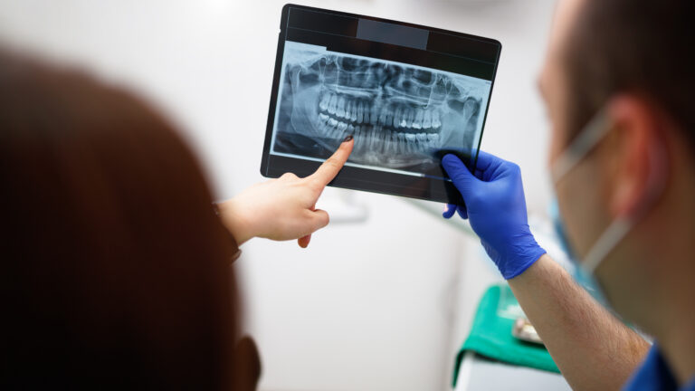 routine-dental-x-rays-are-not-backed-by-evidence—experts-want-it-to-stop