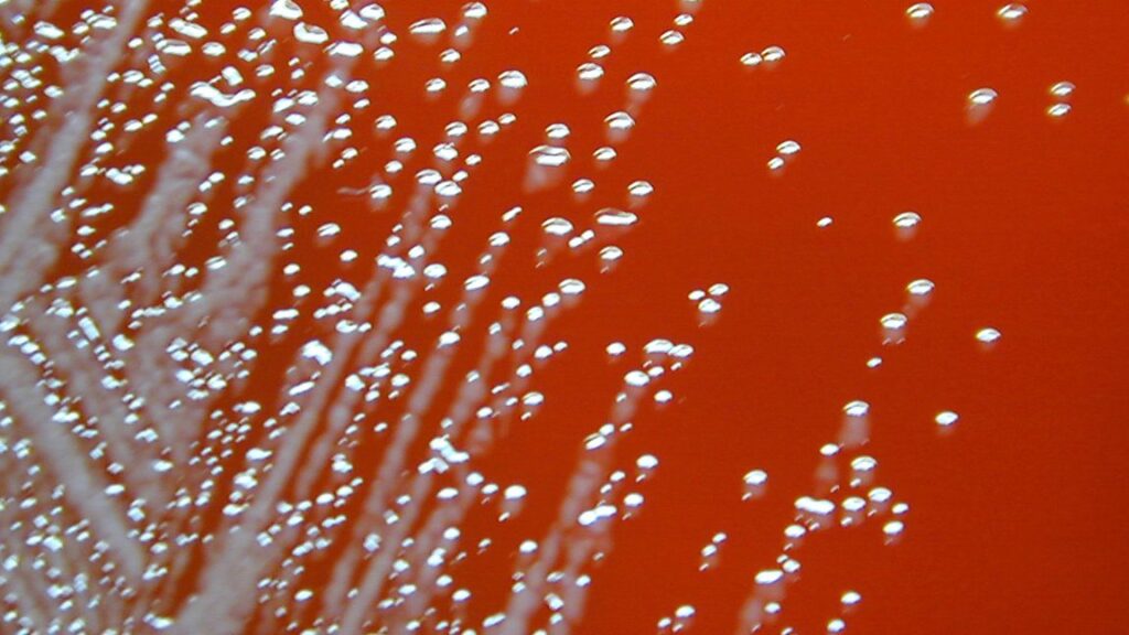 two-men-fell-gravely-ill-last-year;-their-infections-link-to-deaths-in-the-’80s