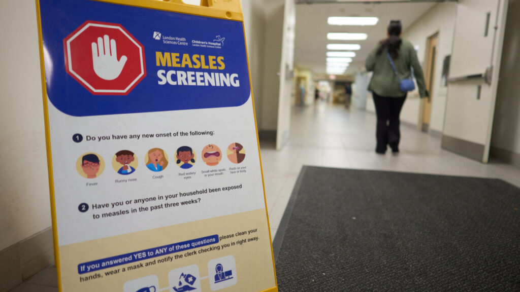 canada-fought-measles-and-measles-won;-virus-now-endemic-after-1998-elimination