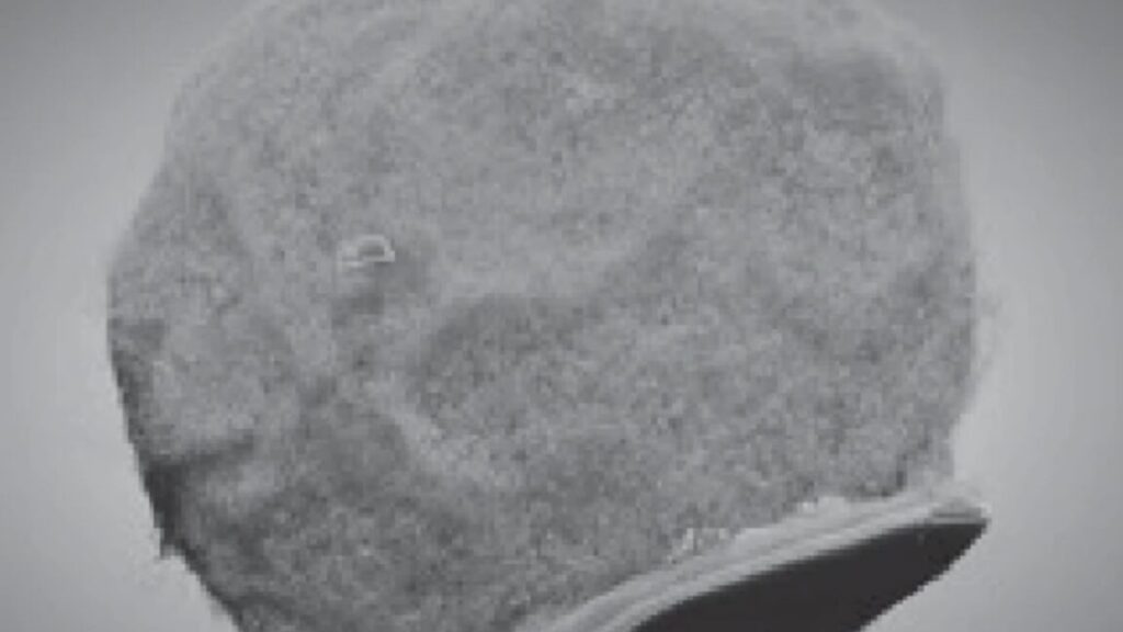 tiny-chips-hitch-a-ride-on-immune-cells-to-sites-of-inflammation