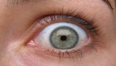 four-inch-worm-hatches-in-woman’s-forehead,-wriggles-to-her-eyelid