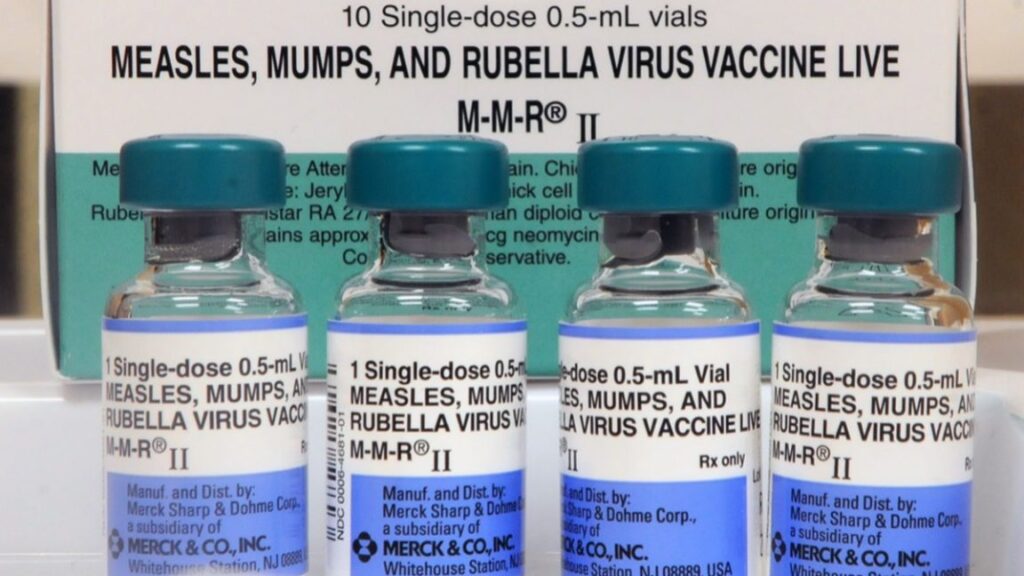 sc-measles-outbreak-has-gone-berserk:-124-cases-since-friday,-409-quarantined